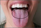 Tongue Back